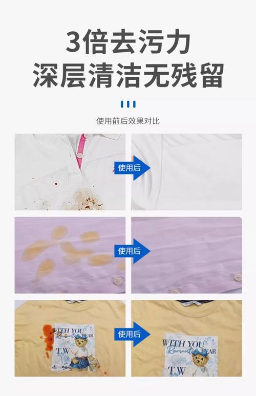 衣物顽固污渍克星:油渍、笔迹、血渍去除大全