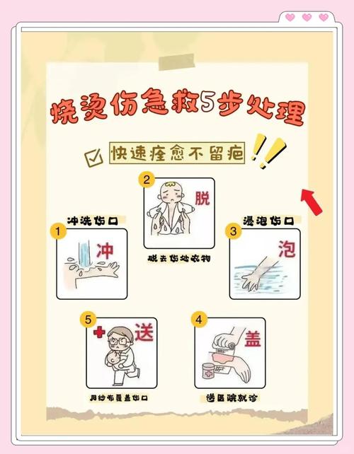 家庭急救手册:遇到烫伤、割伤、噎食该怎么办?